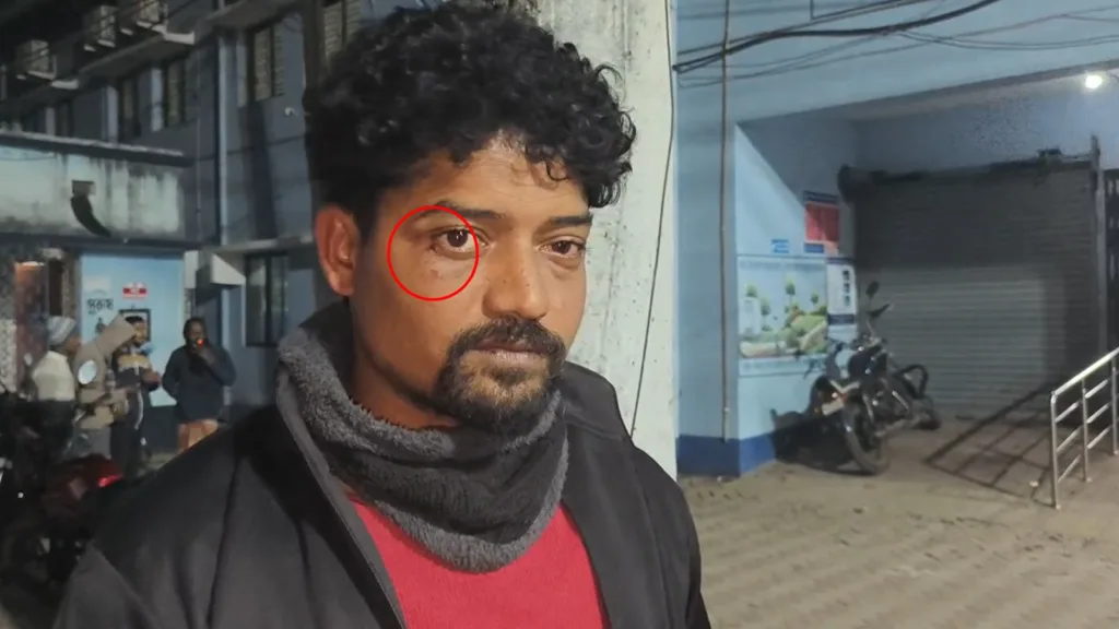 TMC ISF Clash: ফের উত্তপ্ত ভাঙড়, ISF-তৃণমূল সংঘর্ষে জখম দুই পক্ষের কয়েকজন 1 TMC ISF Clash