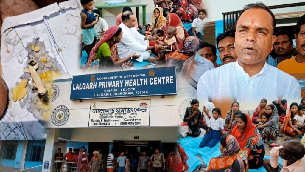 ICDS Food Poisoning