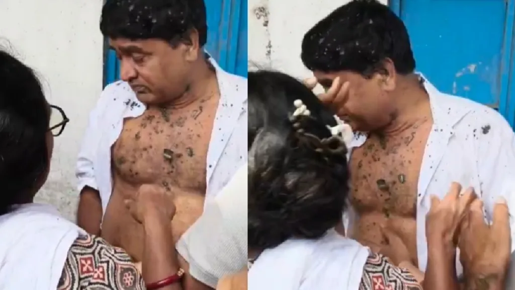 Attack on TMC Councellor